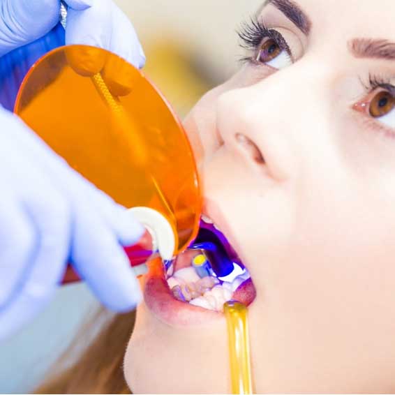 Female-getting-teeth-worked-on-westpoint-dental